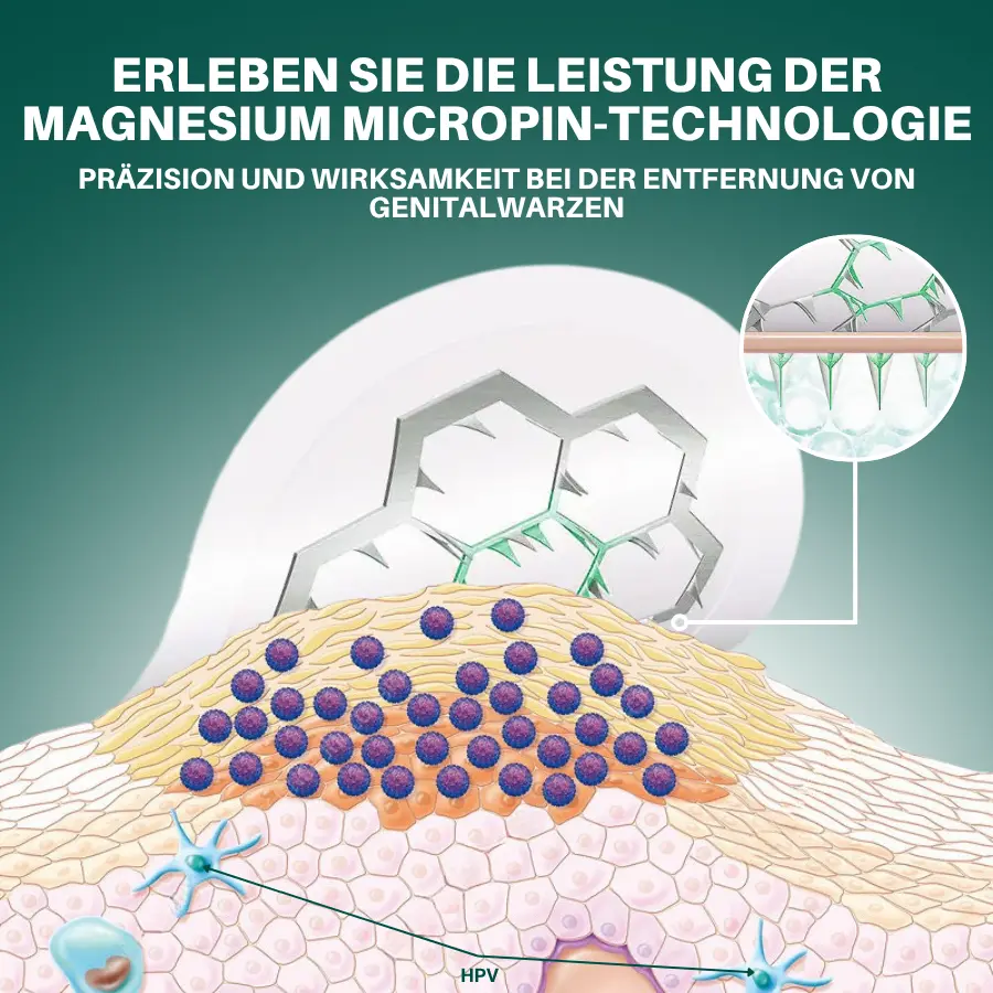 Seurico™ Magnesium Mikropin HPV Genitalien Warzen Entfernung Patch Pro