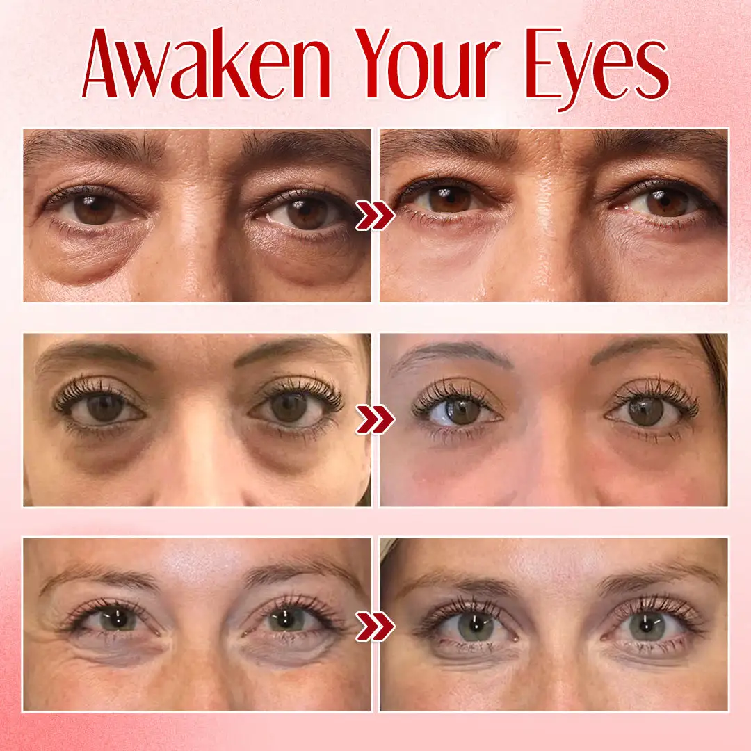 Seurico™ Instant Eye Bag Eraser