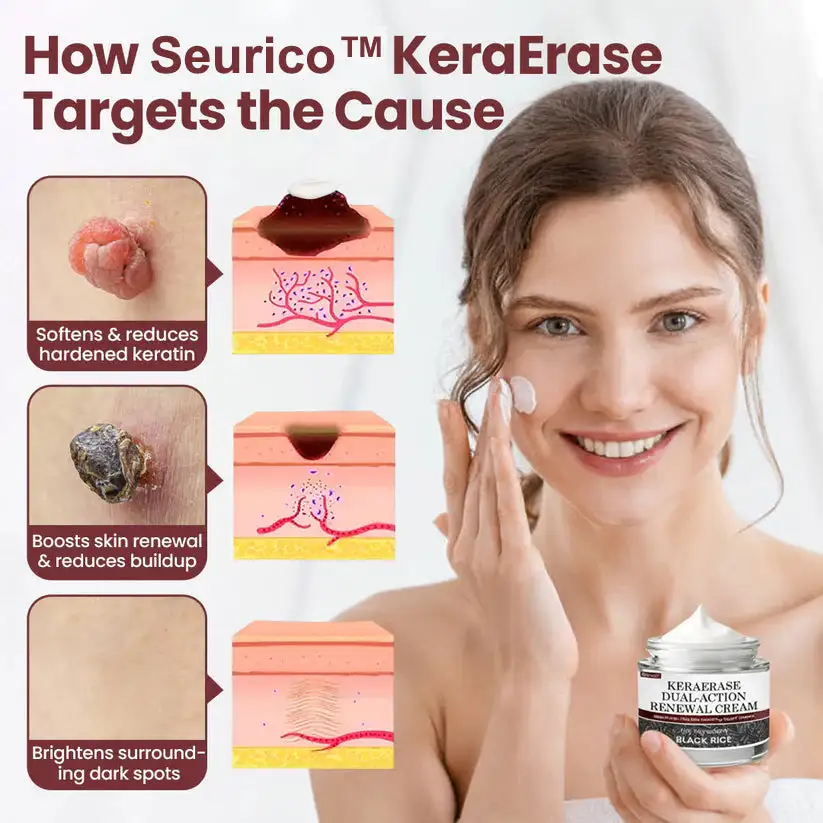 Seurico™KeraErase Dual-Action Renewal Cream