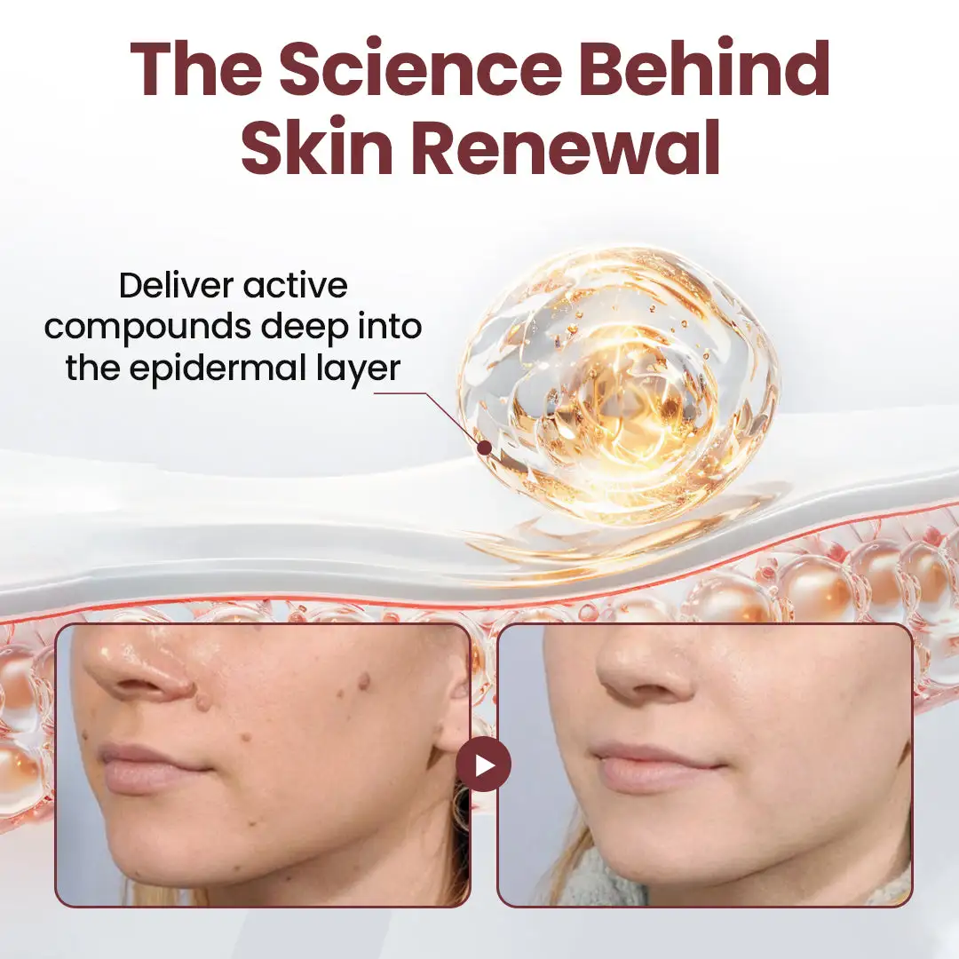 Seurico™KeraErase Dual-Action Renewal Cream