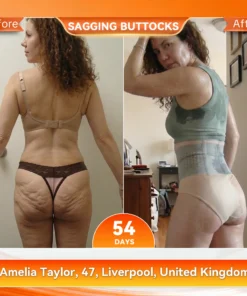SEURICO® Moringa & Berberine 4-In-1 Micro-Particle Sculpting & Fat-Burn Shorts