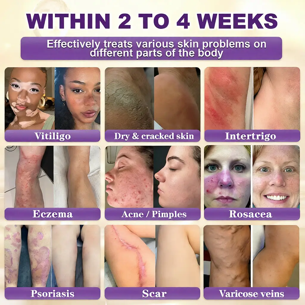 Seurico™ 10-in-1 Biotin Skin Restoration Cream
