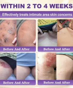 Seurico™ 10-in-1 Biotin Skin Restoration Cream