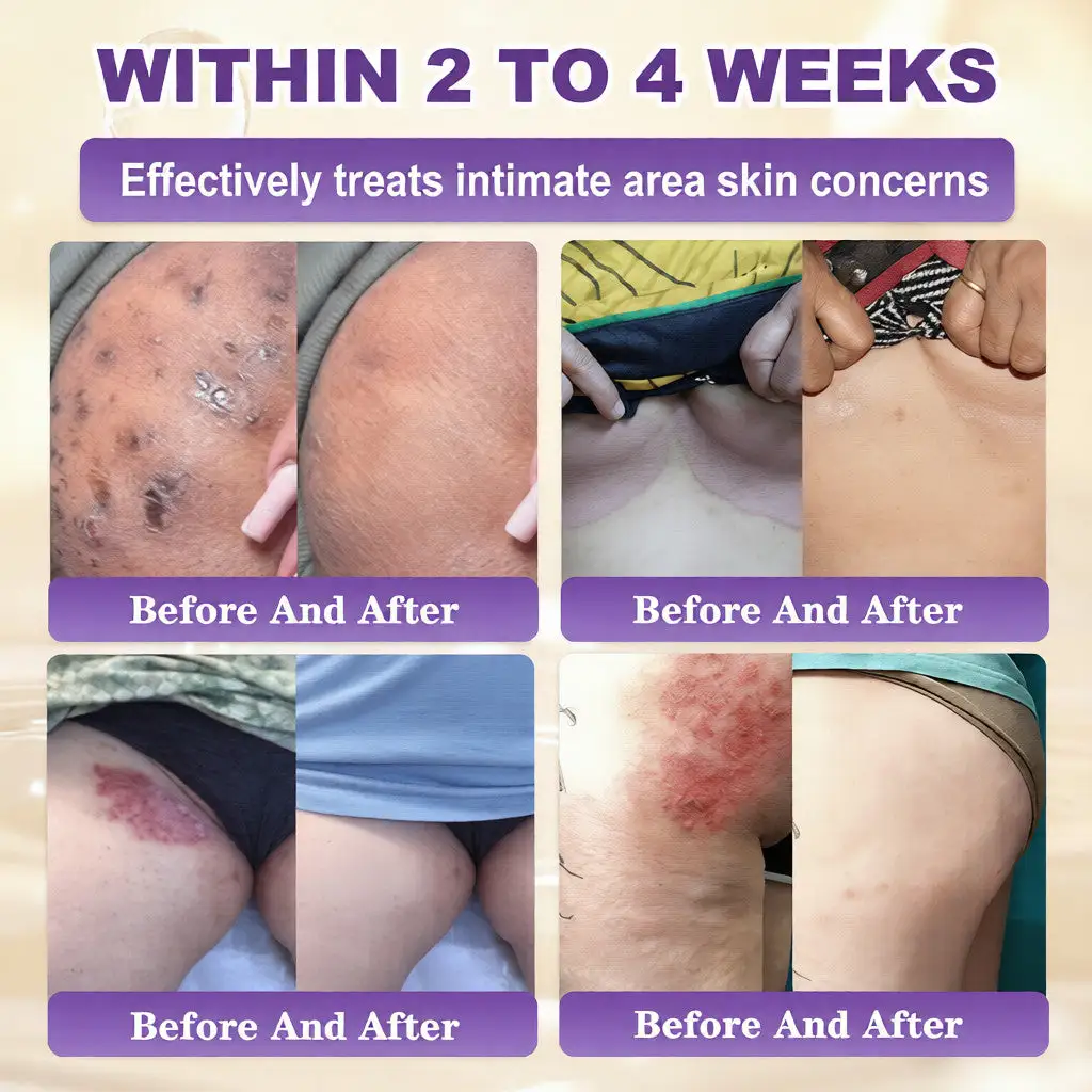 Seurico™ 10-in-1 Biotin Skin Restoration Cream