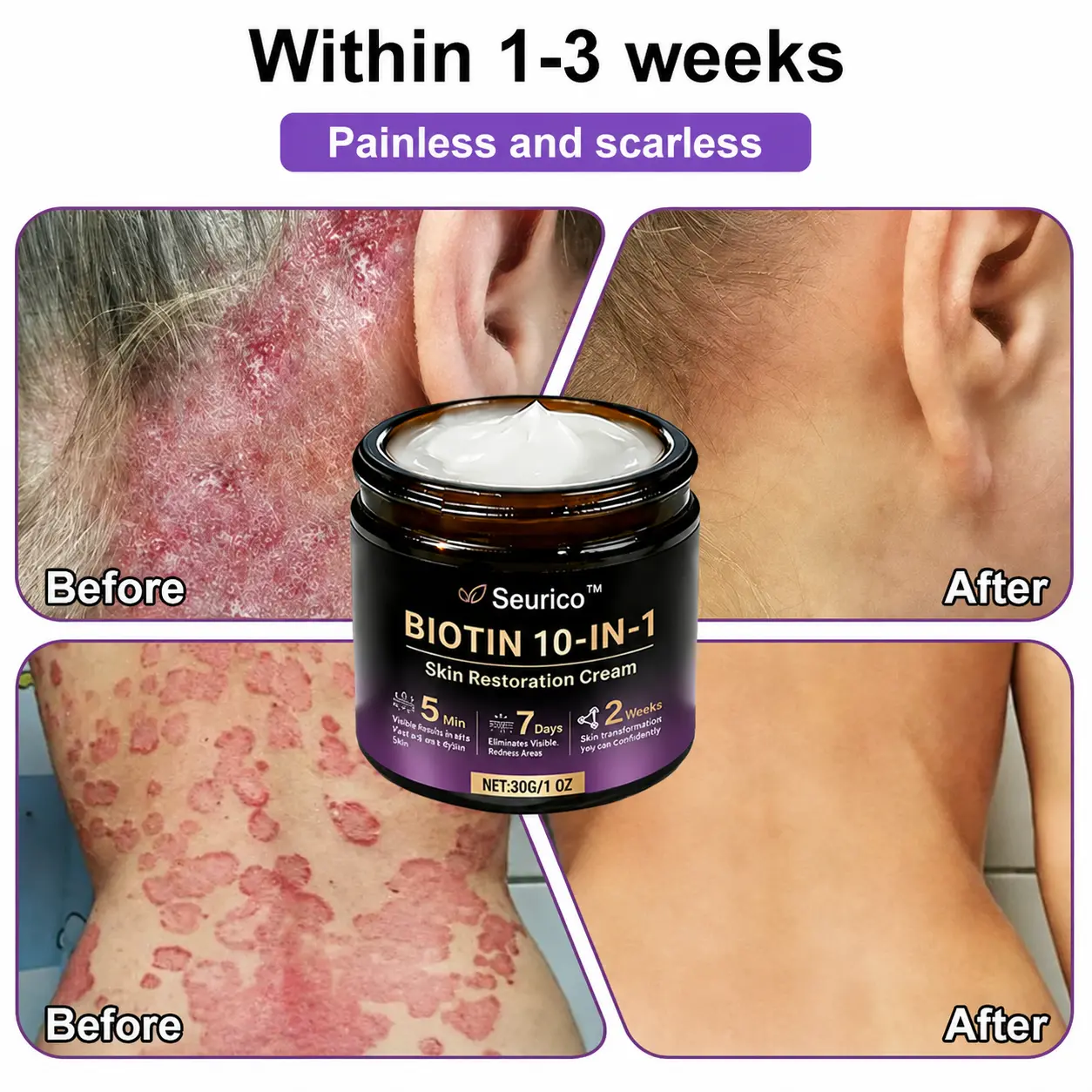 Seurico™ 10-in-1 Biotin Skin Restoration Cream