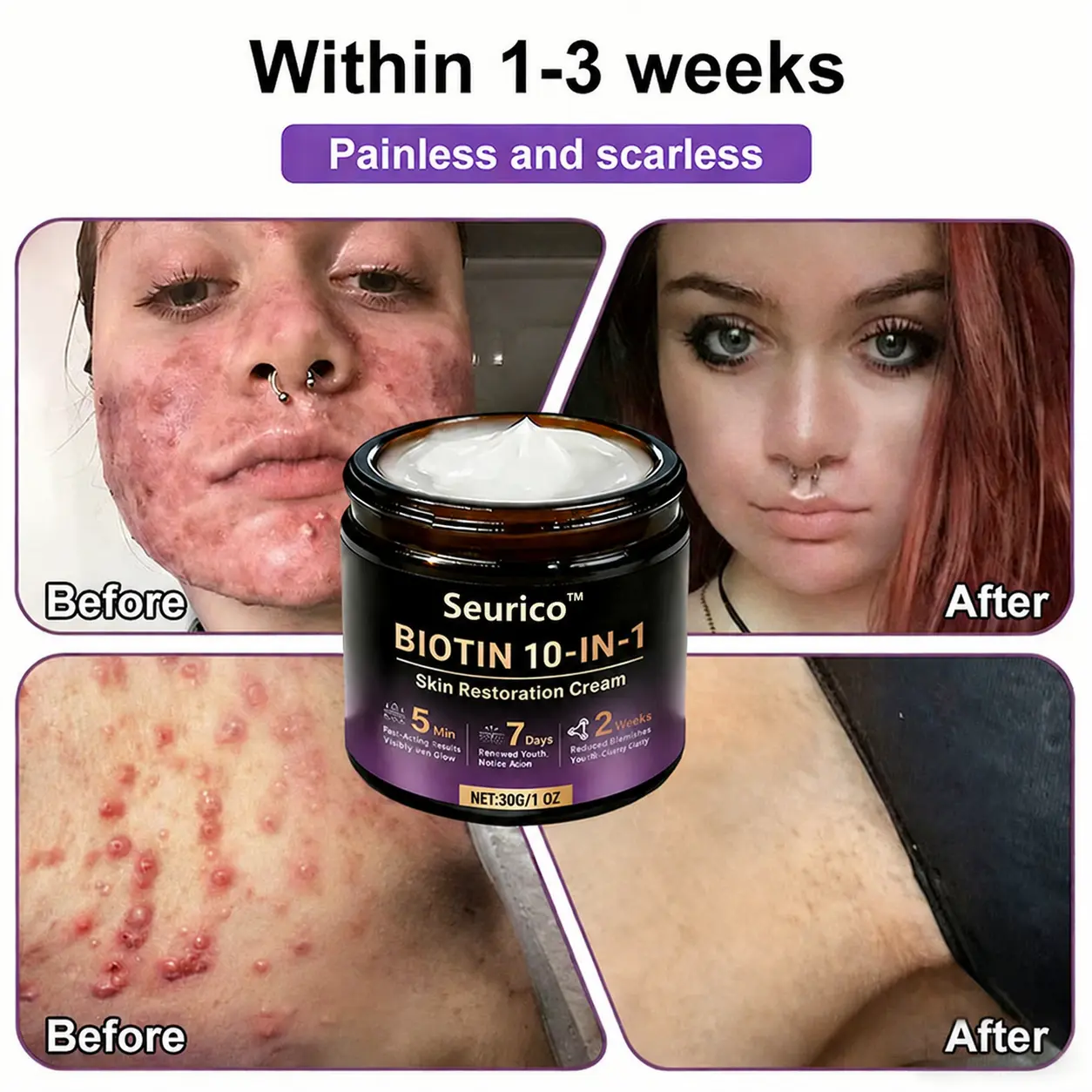Seurico™ 10-in-1 Biotin Skin Restoration Cream