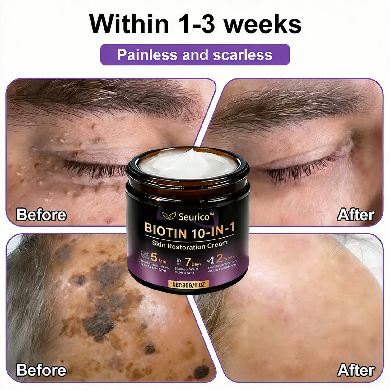 Seurico™ 10-in-1 Biotin Skin Restoration Cream