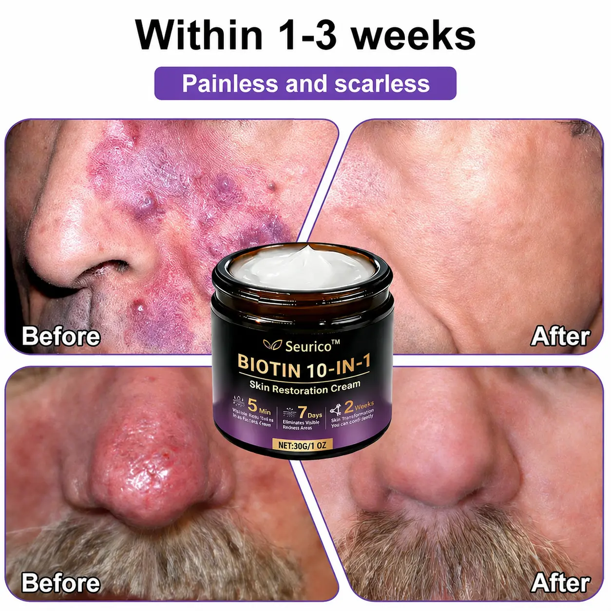 Seurico™ 10-in-1 Biotin Skin Restoration Cream