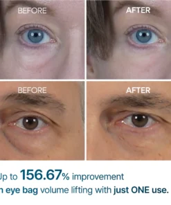 Seurico™ Advanced Firming Under-Eye Cream