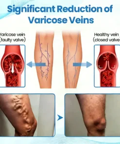 Seurico™ Advanced Vein Healing Spray