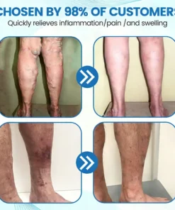 Seurico™ Advanced Vein Healing Spray