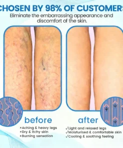 Seurico™ Advanced Vein Healing Spray