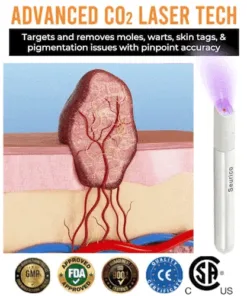 Seurico® All-in-One CO₂ Laser Eraser Pen