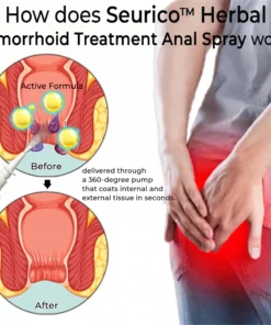 Seurico™ Touch-Free Hemorrhoid Relief Spray