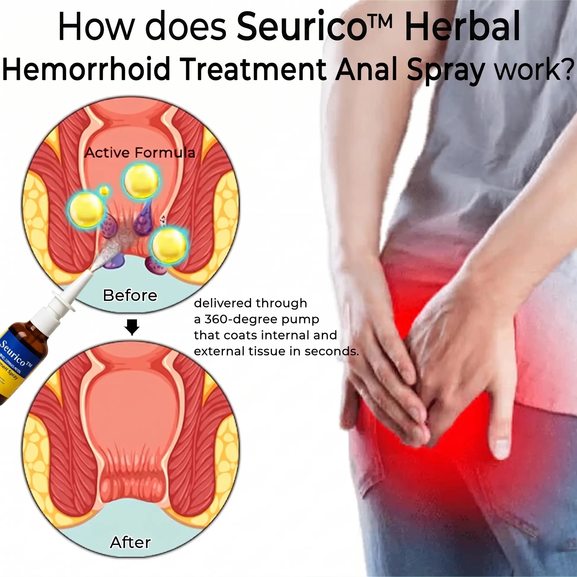 Seurico™ Touch-Free Hemorrhoid Relief Spray