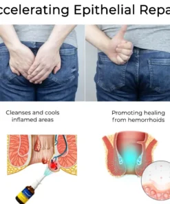 Seurico™ Touch-Free Hemorrhoid Relief Spray